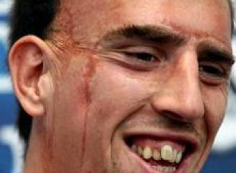 The World Cup Call Girl