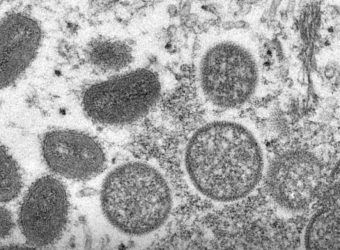 Don’t Get Monkeypox From Rave Sex